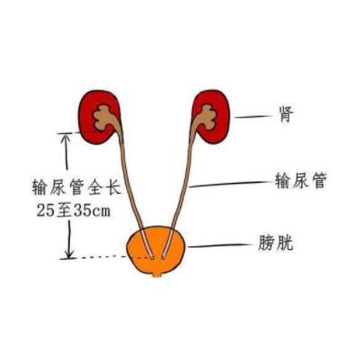 输尿管剥离器